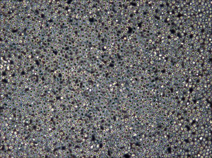 Z-138 Cell Complete Medium - 6