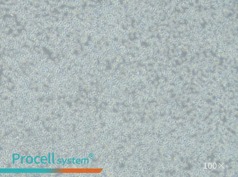 JM-1 Cell Complete Medium - 2