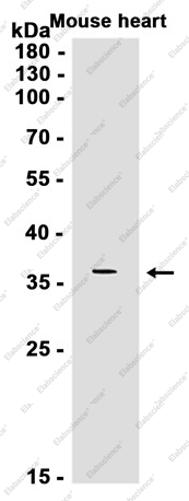 Recombinant GNB3 Monoclonal Antibody - 2