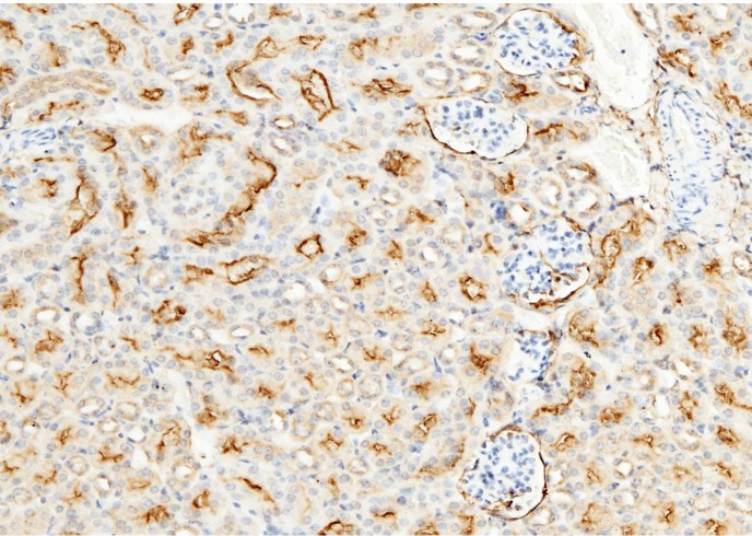 Recombinant CD13/ANPEP Monoclonal Antibody-searchlist-1