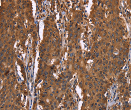 HINT1 Polyclonal Antibody - 2