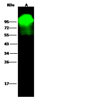 Recombinant Alkaline Phosphatase/ALPL Monoclonal Antibody - small - 1