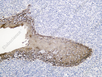 Recombinant Cytokeratin 6 Monoclonal Antibody - 1