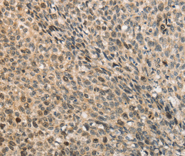CDCA8 Polyclonal Antibody - 3