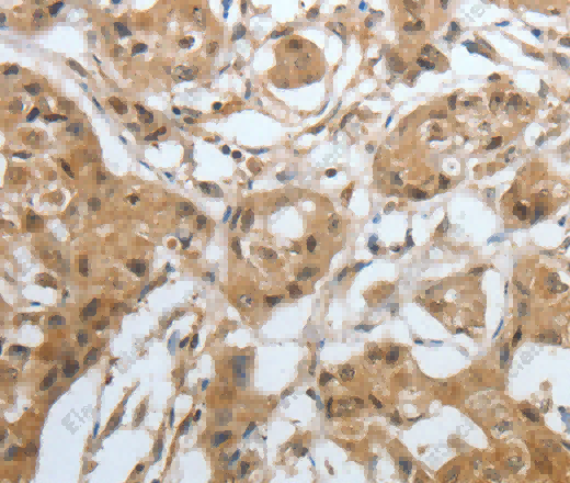 Amphiphysin I Polyclonal Antibody - 3