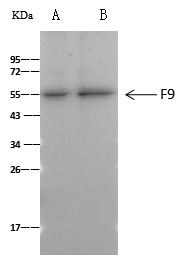 Recombinant Coagulation Factor IX/FIX/F9 Monoclonal Antibody - small - 1