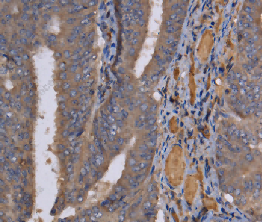 REG3G Polyclonal Antibody - 2