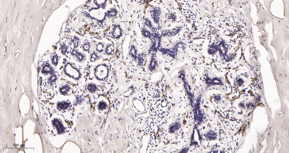 Recombinant FABP4 Monoclonal Antibody - small - 2