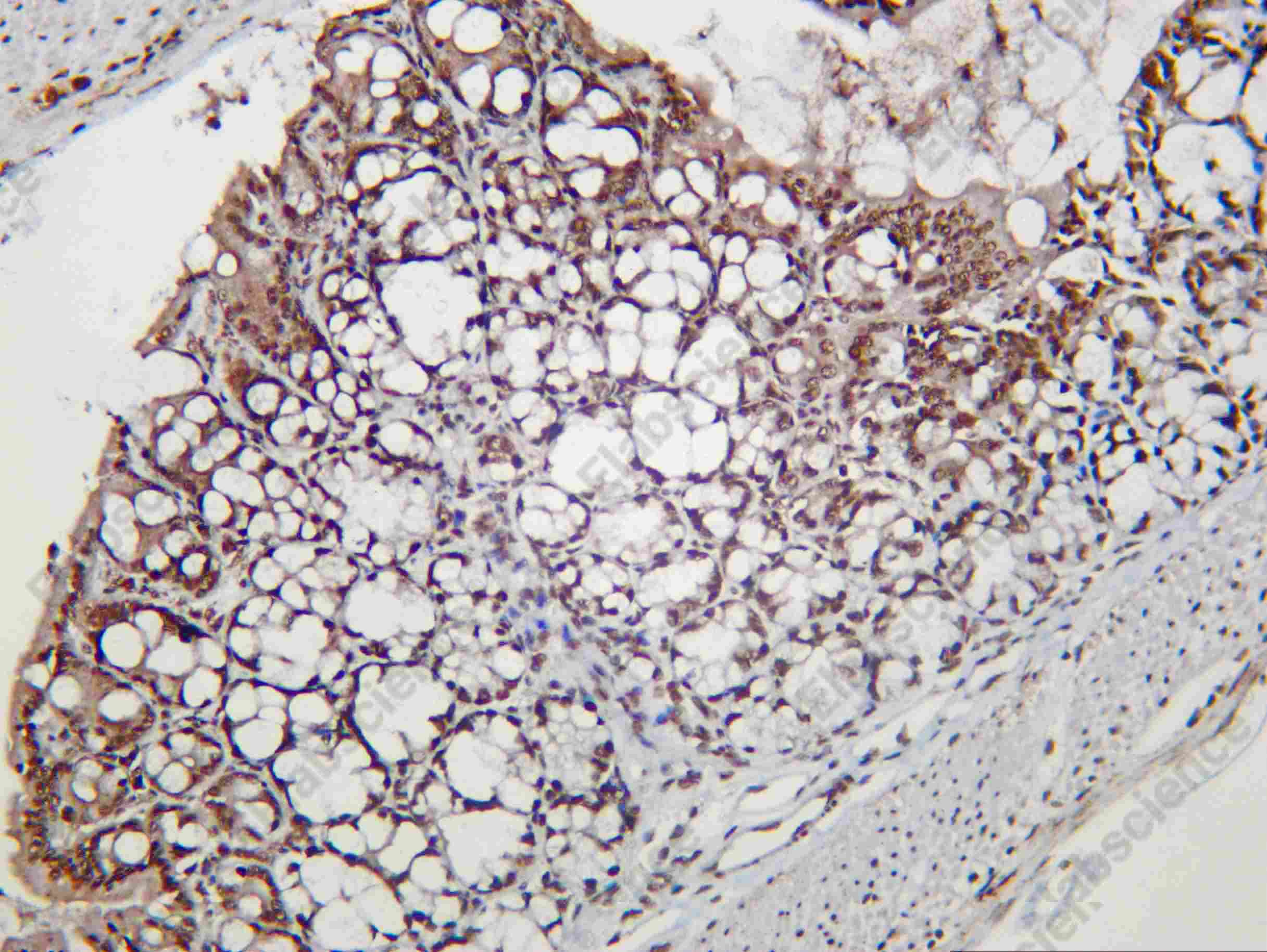 Recombinant Dyskerin Monoclonal Antibody - 3