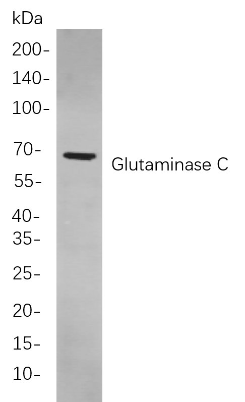 Recombinant Glutaminase C Monoclonal Antibody-searchlist-1