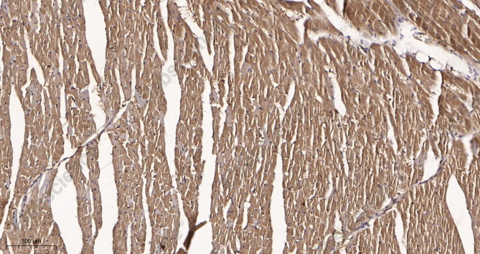 Recombinant Lactate Dehydrogenase Isoenzyme V Monoclonal Antibody - 3