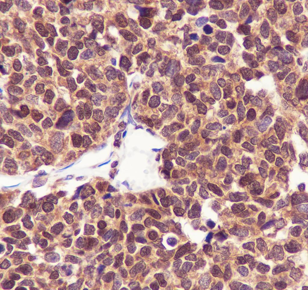Recombinant CIRBP Monoclonal Antibody - small - 3