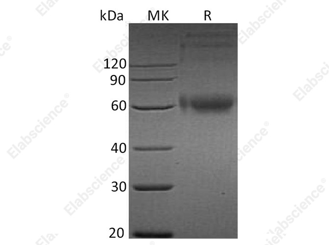 Recombinant Human IL-1RAcP/IL1R3 Protein (His Tag) - 1