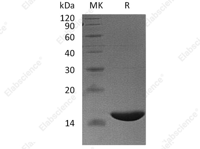 Recombinant Human FABP6/I-BABP Protein (His Tag) - 1