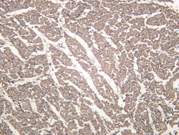 Recombinant COL6A2 Monoclonal Antibody - 1