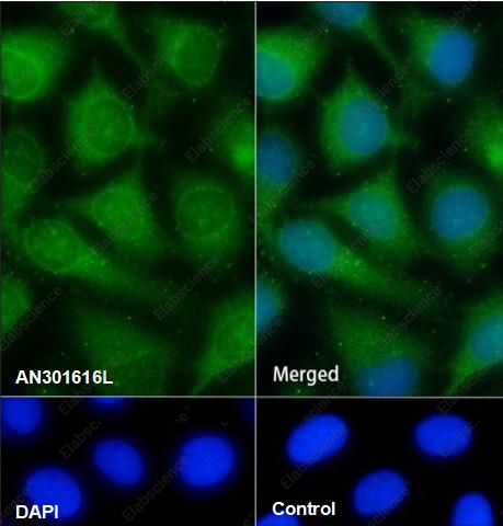 Recombinant ARPC5/p16 ARC Monoclonal Antibody - 3