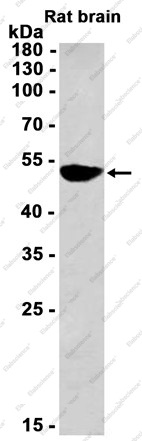 Recombinant FADS1 Monoclonal Antibody - 1