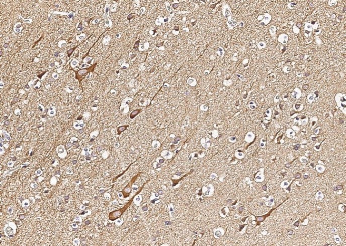 Recombinant VAPB/VAP-B Monoclonal Antibody - small - 4