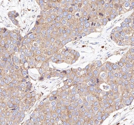 Recombinant RPL26L1 Monoclonal Antibody-searchlist-2
