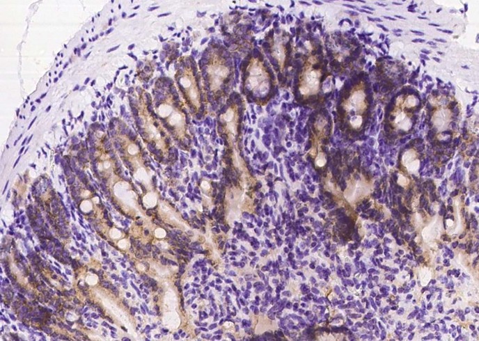 Recombinant Transferrin Receptor/TFRC Monoclonal Antibody - small - 3