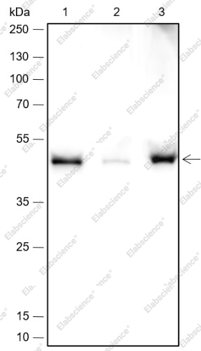 Recombinant PDK2 Monoclonal Antibody - 2