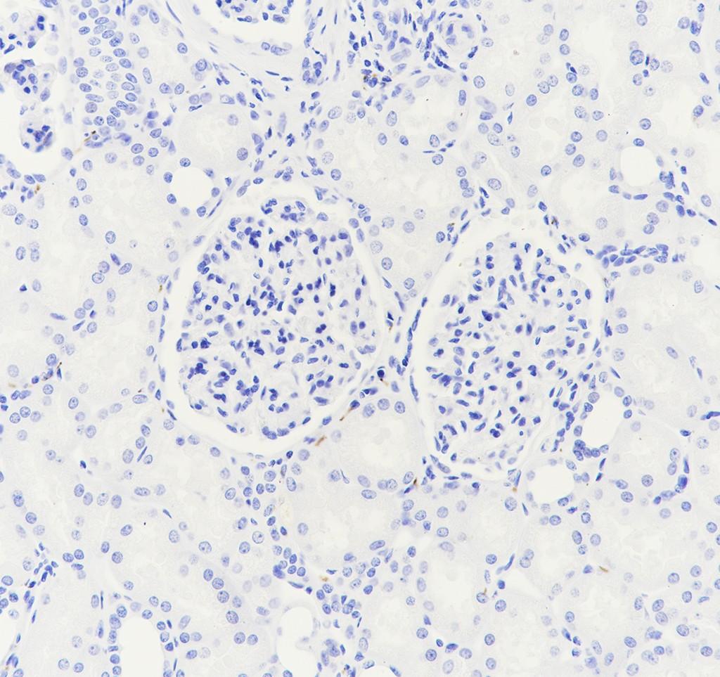 Recombinant Dopamine beta Hydroxylase Monoclonal Antibody - small - 2