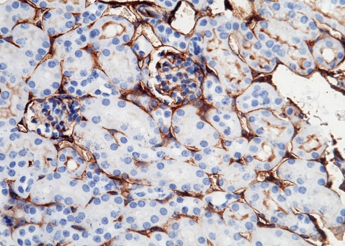 Recombinant ICAM-1/CD54 Monoclonal Antibody-searchlist-1