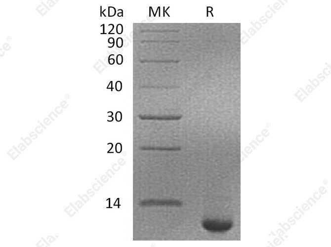 Recombinant Human SPINK4 Protein (His Tag) - 1
