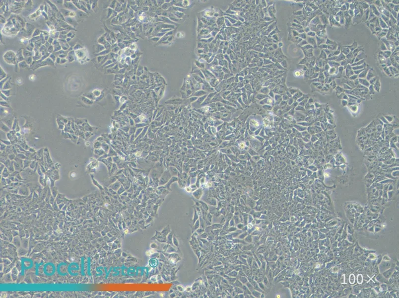 HCT-15 Cell Complete Medium - 1