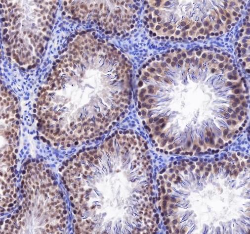 Recombinant Rad51 Monoclonal Antibody - small - 3