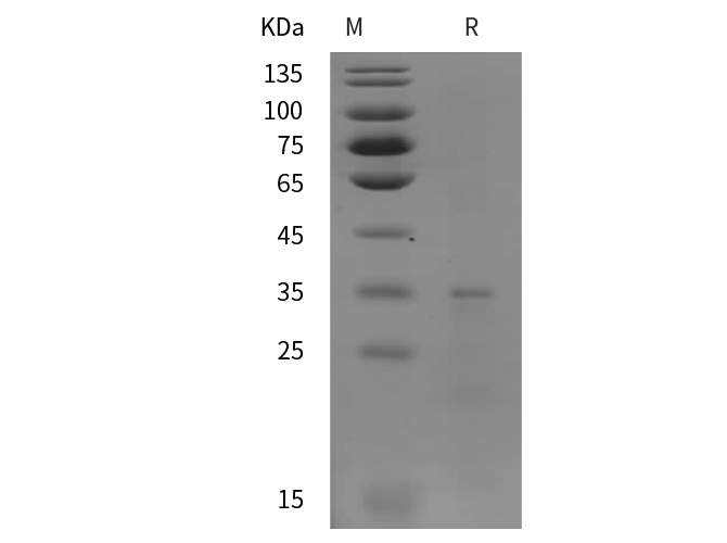 Recombinant Mouse IL-1ra/IL-1F3 Protein(His Tag)-产品推荐-1
