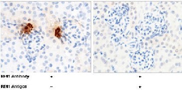Recombinant REN1/Renin-1 Monoclonal Antibody-searchlist-1