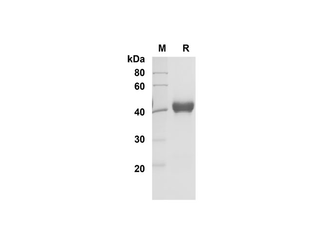 Recombinant Human IL-5 Protein(Fc Tag)-1