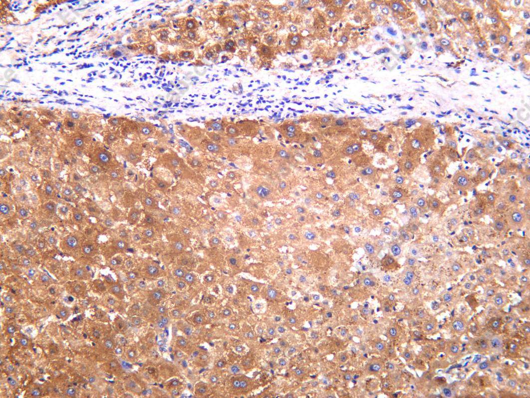 Recombinant IRS2 Monoclonal Antibody - 1