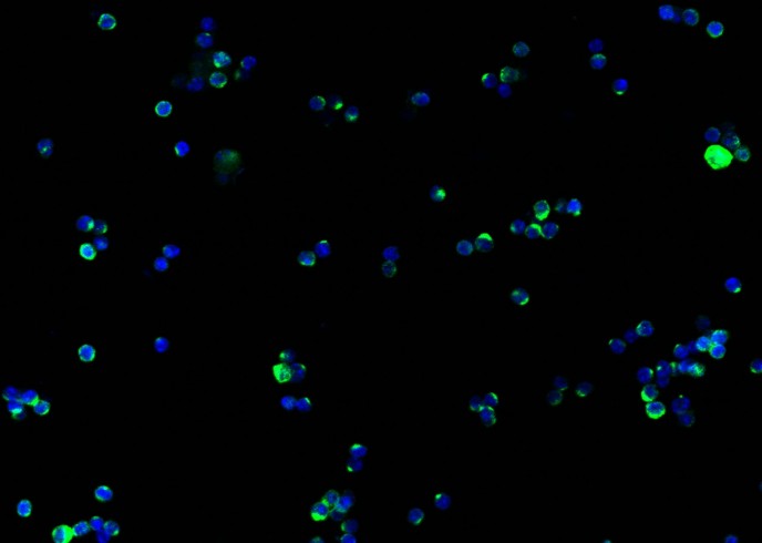 Recombinant IFN gamma Monoclonal Antibody-searchlist-1