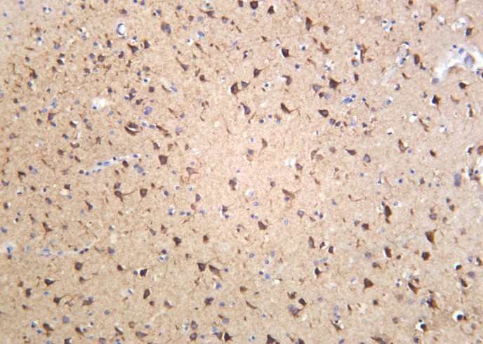 Recombinant Sortilin Monoclonal Antibody-searchlist-1