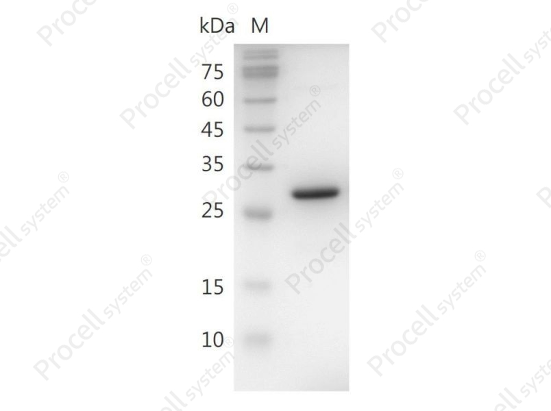 HMGB1/HMG-1/HMG1/HMG3/SBP-1, Human, Recombinant