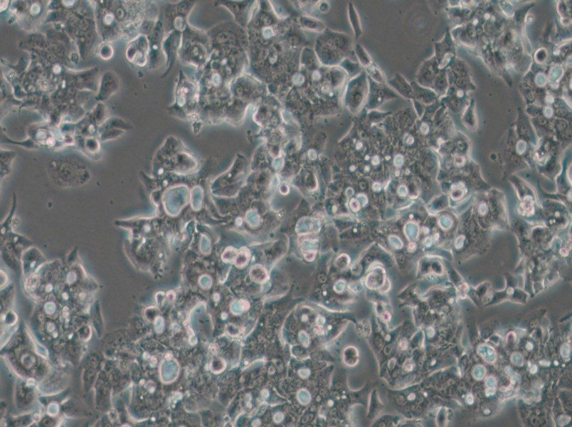 OE19 Cell Complete Medium - 4