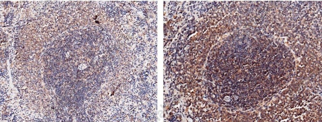 Interleukin-2/IL-2 Monoclonal Antibody - 1