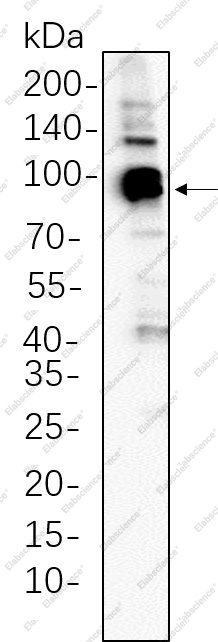 Recombinant STAT5A Monoclonal Antibody - 1