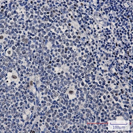 Recombinant PREB Monoclonal Antibody - 2