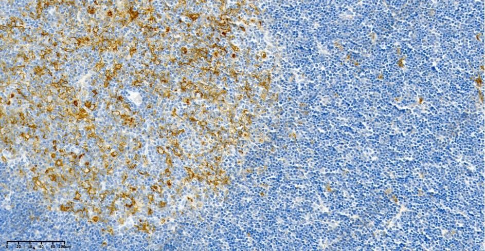 Recombinant HLA-DR Monoclonal Antibody - 2