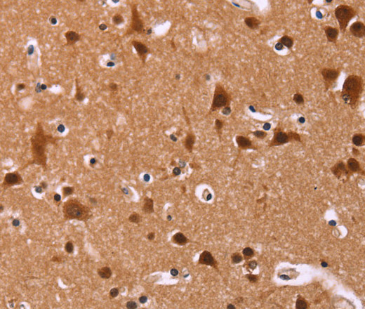 Immunohistochemistry of paraffin-embedded Human brain  tissue using ART5 Polyclonal Antibody at dilution 1:50