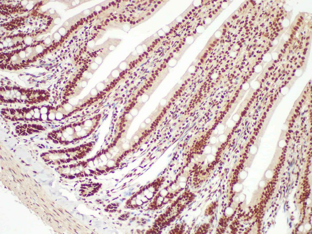 Purified Anti-Human CD20 Antibody[BCA/B20]-产品推荐-1
