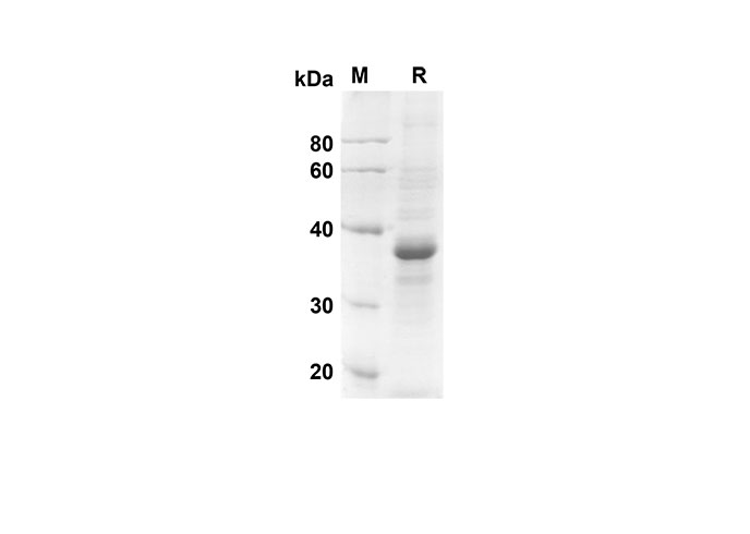 Recombinant Human IFNA2 Protein(Gst Tag)-产品推荐-1