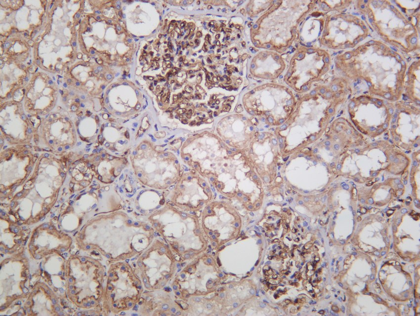 Recombinant B2M/beta-2 microglobulin Monoclonal Antibody - 3