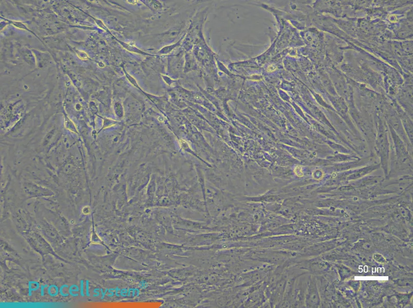 Mouse Bladder Smooth Muscle Cell Complete Medium - 4