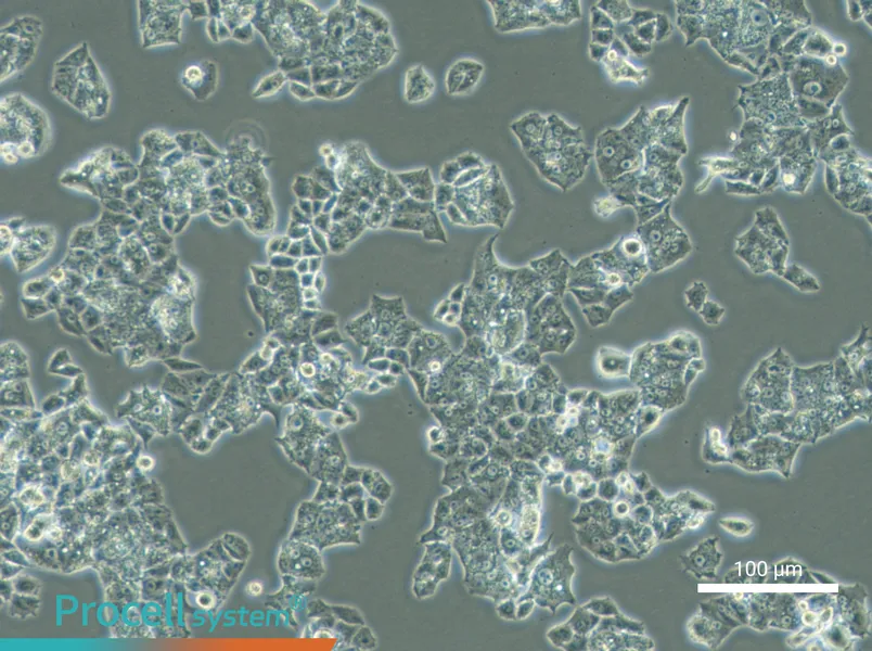 NCI-H1395NCI-H1395 - 2