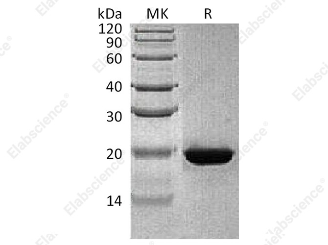 Recombinant Human RBP4 Protein - 1