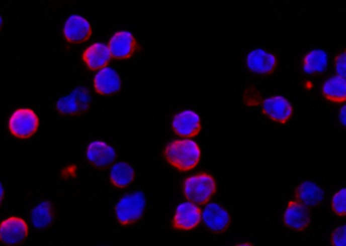 Recombinant IFNAR1 Monoclonal Antibody-searchlist-1